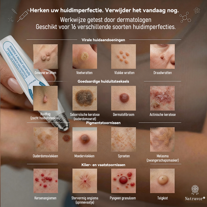 🔥🔥Officiële merkshop | 🖊️Natravor® 7-daagse wratten- en vlekkenverwijderaar (pijnstillende applicator voor nauwkeurig aanbrengen, laat geen littekens achter)🌳