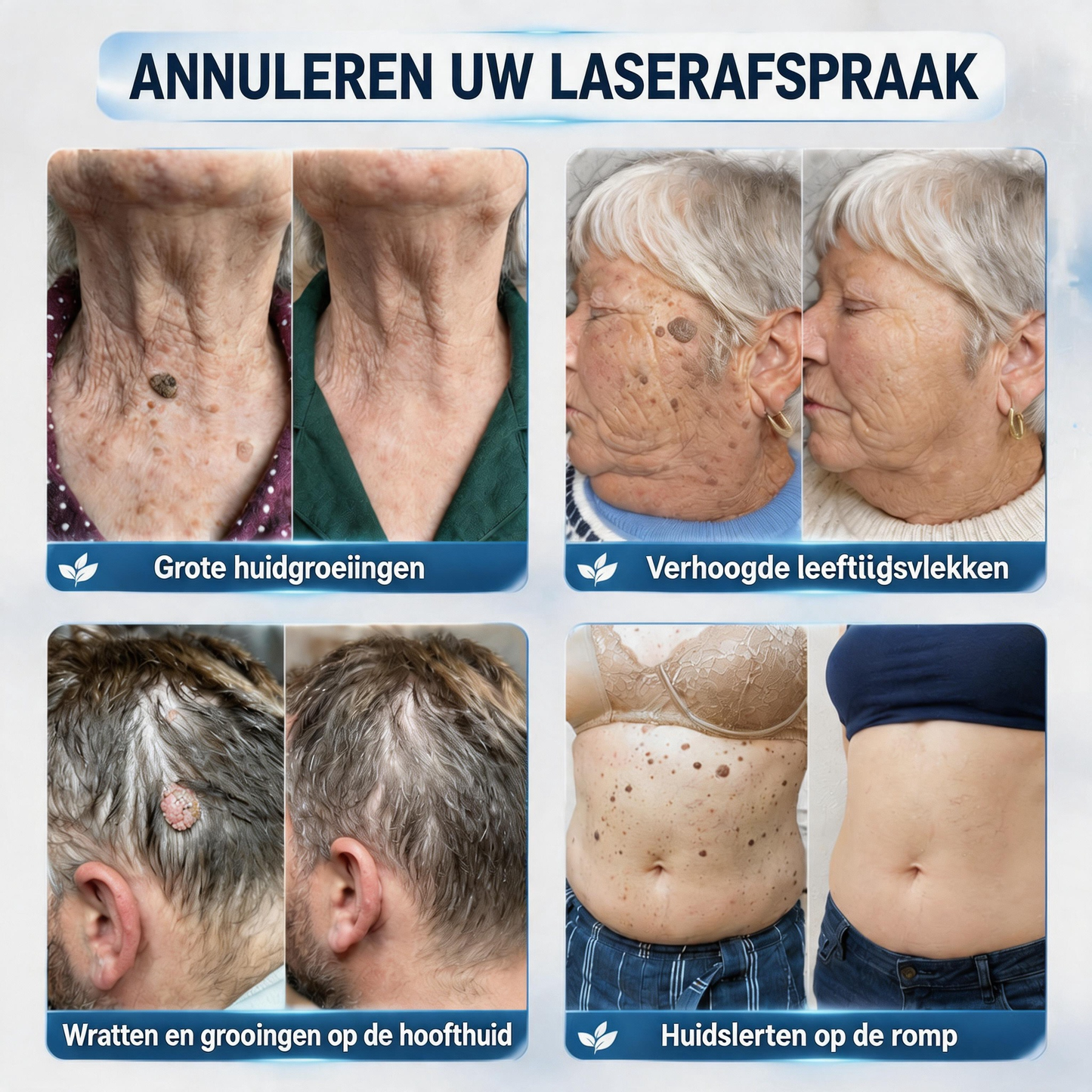 🔥🔥Officiële merkshop | 🖊️Natravor® 7-daagse wratten- en vlekkenverwijderaar (pijnstillende applicator voor nauwkeurig aanbrengen, laat geen littekens achter)🌳